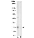 Western blot testing of mouse liver lysate with Kallikrein 6 antibody at 2ug/ml with [B] and without [A] blocking/immunizing peptide. Predicted molecular weight: ~27kDa.