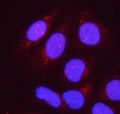 Immunofluorescent staining of FFPE human HeLa cells with PPP1R15B antibody (red) and DAPI nuclear stain (blue). HIER: steam section in pH6 citrate buffer for 20 min.