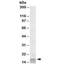 Western blot testing of human skeletal muscle lysate with SCOC antibody at 0.1ug/ml. Predicted molecular weight: ~11-18kDa (isoforms 1-6).