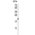 Western blot testing of human NCI-H460 cell lysate with PTP4A2 antibody. Predicted molecular weight ~19 kDa.