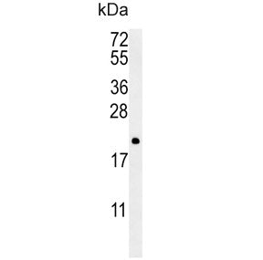Western blot testing of human NCI-H460 cell lysate with PTP4A2 antibody. Predicted molecular weight ~19 kDa.