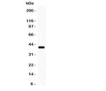 Western blot testing of EDA antibody and COLO320 lysate