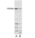Western blot testing of HFF cell lysate and A) control siRNA or B) 100nM siRNA with SECISBP2 antibody at 0.2ug/ml.