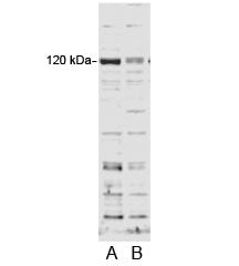 Western blot testing of HFF cell lysate and A) control siRNA or B) 100nM siRNA with SECISBP2 antibody at 0.2ug/ml.