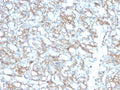 IHC testing of FFPE lung carcinoma with biotin-conjugated PD-L1 antibody (clone PDL1/2746). HIER: boil tissue sections in pH 9 10mM Tris with 1mM EDTA for 10-20 min followed by cooling at RT for 20 min.