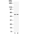 Western blot testing of 1) rat thymus and 2) human Jurkat lysate with VRK1 antibody. Predicted molecular weight ~45 kDa, observed here at ~55 kDa.