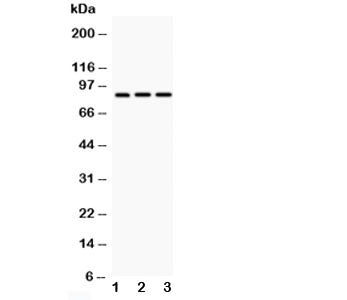 Western blot testing of CD18 antibody and Lane 1: HeLa; 2: Jurkat; 3: HT1080; Predicted/Observed molecular weight: 85~95KD depending on glycosylation level.