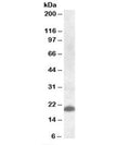 Western blot testing of human spleen lysate with CLEC4C antibody at 1ug/ml. Predicted molecular weight: ~21kDa.