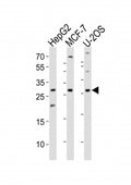 Western blot analysis of lysate from HepG2, MCF-7, U-2OS cell line (left to right) using ID1 antibody; Ab was diluted at 1:1000 for each lane.
