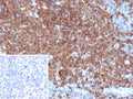 IHC staining of FFPE human tonsil tissue with GCSF antibody (clone CSF3/4599). Inset: PBS used in place of primary Ab (secondary Ab negative control). HIER: boil tissue sections in pH 9 10mM Tris with 1mM EDTA for 20 min and allow to cool before testing.