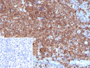 IHC staining of FFPE human tonsil tissue with GCSF antibody (clone CSF3/4599). Inset: PBS used in place of primary Ab (secondary Ab negative control). HIER: boil tissue sections in pH 9 10mM Tris with 1mM EDTA for 20 min and allow to cool before testing.