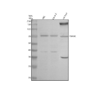 Western blot analysis of Twinkle/TWNK using anti-TWNK antibody. Electrophoresis was performed on a 10% SDS-PAGE gel at 80V (Stacking gel) / 120V (Resolving gel) for 2 hours. Lane 1: human HEL whole cell lysates, Lane 2: human Caco-2 whole cell lysates, Lane 3: rat liver tissue lysates. After electrophoresis, proteins were transferred to a nitrocellulose membrane at 150 mA for 50-90 min. Blocked the membrane with 5% non-fat milk/TBS for 1.5 hour at RT.