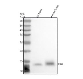 Western blot analysis of HBZ using anti-HBZ antibody. Lane 1: rat bone tissue lysates, Lane 2: mouse bone tissue lysates. After electrophoresis, proteins were transferred to a nitrocellulose membrane at 150 mA for 50-90 min. Blocked the membrane with 5% non-fat milk/TBS for 1.5 hour at RT.