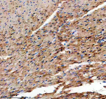 Immunohistochemical staining of TMOD1 using anti-TMOD1 antibody. TMOD1 was detected in a paraffin-embedded section of mouse erythrocyte tissue. Heat mediated antigen retrieval was performed in EDTA buffer (pH 8.0, epitope retrieval solution). The tissue section was blocked with 10% goat serum. The tissue section was then incubated with 2 ug/ml rabbit anti-TMOD1 antibody overnight at 4oC. Peroxidase Conjugated Goat Anti-rabbit IgG was used as secondary antibody and incubated for 30 min at 37oC.