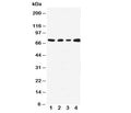 Western blot testing with MEKK3 antibody; Lane 1: HeLa; 2: A431; 3: MCF-7; 4: Jurkat cell lysate. Expected size ~71KD