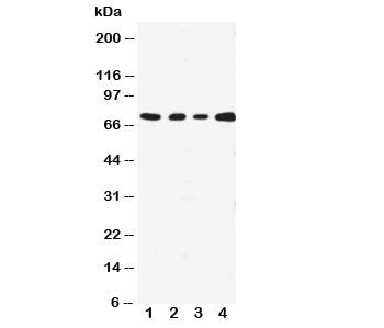 Western blot testing with MEKK3 antibody; Lane 1: HeLa; 2: A431; 3: MCF-7; 4: Jurkat cell lysate. Expected size ~71KD