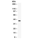Western blot testing of human SW620 cell lysate with TRIB2 antibody. Expected/observed molecular weight ~39 kDa.