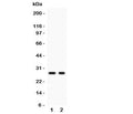 Western blot testing of Kallikrein 4 antibody and Lane 1: 293T; 2: MCF-7 lysate. Predicted size ~27KD, observed size 27~32KD