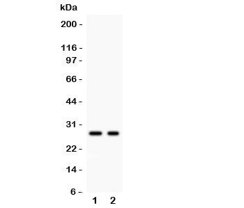 Western blot testing of Kallikrein 4 antibody and Lane 1: 293T; 2: MCF-7 lysate. Predicted size ~27KD, observed size 27~32KD