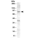 Western blot testing of A549 cell lysate with EXO1 antibody at 0.2ug/ml. The expected 94-115 kDa band and the additional ~38 kDa band are both blocked by the immunizing peptide.