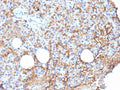 IHC staining of FFPE human parathyroid tissue with CD109 antibody (clone CD109/9949). HIER: boil tissue sections in pH 9 10mM Tris with 1mM EDTA for 20 min and allow to cool before testing.