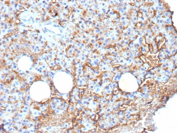 IHC staining of FFPE human parathyroid tissue with CD109 antibody (clone CD109/9949). HIER: boil tissue sections in pH 9 10mM Tris with 1mM EDTA for 20 min and allow to cool before testing.