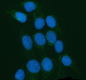 Immunofluorescent staining of POLDIP2 using anti-POLDIP2 antibody (green). POLDIP2 was detected in an immunocytochemical section of U2OS cells. Enzyme antigen retrieval was performed using IHC enzyme antigen retrieval reagent for 15 mins. The cells were blocked with 10% goat serum. And then incubated with 5 ug/ml rabbit anti-POLDIP2 antibody overnight at 4oC. DyLight 488 Conjugated Goat Anti-Rabbit IgG was used as secondary antibody at 1:500 dilution and incubated for 30 min at 37oC.