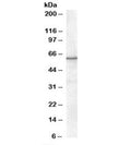 Western blot testing of nuclear HeLa lysate with RXR alpha antibody at 0.3ug/ml. Predicted molecular weight: ~51kDa but routinely observed at 54~60kDa.