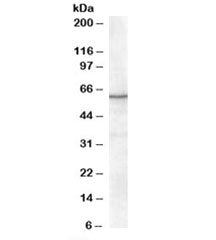 Western blot testing of nuclear HeLa lysate with RXR alpha antibody at 0.3ug/ml. Predicted molecular weight: ~51kDa but routinely observed at 54~60kDa.