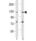Western blot testing of AATK antibody at 1:2000 dilution. Lane 1: HeLa lysate; 2: NIH3T3 lysate; Predicted band size : 145 kDa.