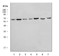 Western blot testing of 1) human 293T, 2) human HeLa, 3) human placenta, 4) human U-87 MG, 5) human A431, 6) rat heart and 7) mouse NIH 3T3 cell lysate with AMPK gamma 2 antibody. Predicted molecular weight ~63 kDa.