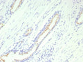 IHC staining of FFPE human prostate tissue with recombinant SLC45A3 antibody (clone SLC45A3/9216R). HIER: boil tissue sections in pH 9 10mM Tris with 1mM EDTA for 20 min and allow to cool before testing.