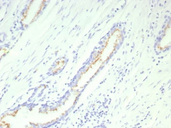 IHC staining of FFPE human prostate tissue with recombinant SLC45A3 antibody (clone SLC45A3/9216R). HIER: boil tissue sections in pH 9 10mM Tris with 1mM EDTA for 20 min and allow to cool before testing.