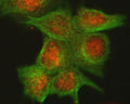 Immunofluorescent staining of FFPE human MCF7 cells with Cdk4 antibody (red) and Alpha Tubulin mAb (green). HIER: steam section in pH6 citrate buffer for 20 min.
