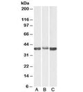 Western blot testing of A) human, B) mouse and C) rat skeletal muscle lysates with Aldolase A antibody at 0.03ug/ml. Predicted molecular weight: ~40kDa.