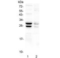 Western blot testing of 1) mouse liver and 2) mouse stomach lysate with COMT antibody at 0.5ug//ml. Predicted molecular weight: ~30/25 kDa (isoforms 1/2).