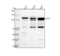Western blot analysis of AXIN1 using anti-AXIN1 antibody. Lane 1: human whole cell lysates, Lane 2: human whole cell lysates, Lane 3: human K562 whole cell lysates. After electrophoresis, proteins were transferred to a nitrocellulose membrane at 150 mA for 50-90 min. Blocked the membrane with 5% non-fat milk/TBS for 1.5 hour at RT.