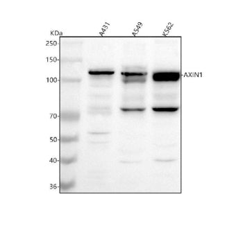 Western blot analysis of AXIN1 using anti-AXIN1 antibody. Lane 1: human whole cell lysates, Lane 2: human whole cell lysates, Lane 3: human K562 whole cell lysates. After electrophoresis, proteins were transferred to a nitrocellulose membrane at 150 mA for 50-90 min. Blocked the membrane with 5% non-fat milk/TBS for 1.5 hour at RT.