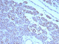 IHC staining of FFPE human parathyroid tissue with c-RET antibody (clone RET/8791). HIER: boil tissue sections in pH 9 10mM Tris with 1mM EDTA for 20 min and allow to cool before testing.