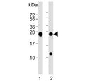 Western blot testing of human 1) K562 and 2) MCF7 cell lysate with PSMB1 antibody. Predicted molecular weight ~26 kDa.