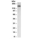 Western blot testing of human colon lysate with MYLK antibody at 0.03ug/ml. Predicted molecular weight: isoforms from 197-211 kDa and ~110 kDa, observed here at ~150 kDa.