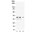 Western blot testing of 1) rat kidney, 2) mouse kidney and 3) human HeLa lysate with DDAH1 antibody at 0.5ug/ml. Expected molecular weight: 31-38 kDa.