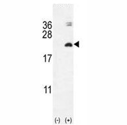 Western blot analysis of IL17F antibody and 293 cell lysate (2 ug/lane) either nontransfected (Lane 1) or transiently transfected with the IL17F gene (2).