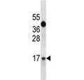 IGF1 antibody western blot analysis in A549 lysate. Predicted molecular weight ~15 kDa.