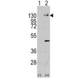 Western blot analysis of PDGFR antibody and 293 cell lysate (2 ug/lane) either nontransfected (Lane 1) or transiently transfected with the PDGFRA gene (2). Predicted molecular weight: 120-195 kDa.