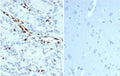 IHC staining of FFPE human prostate tissue (left) and negative control human brain tissue (right) with recombinant ERG antibody (clone ERG/22R) at 1ug/ml. HIER: boil tissue sections in pH 9 10mM Tris with 1mM EDTA for 20 min and allow to cool before testing.