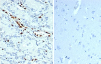 IHC staining of FFPE human prostate tissue (left) and negative control human brain tissue (right) with recombinant ERG antibody (clone ERG/22R) at 1ug/ml. HIER: boil tissue sections in pH 9 10mM Tris with 1mM EDTA for 20 min and allow to cool before testing.