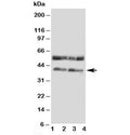 Western blot testing of CCR5 antibody and Lane 1: COLO320; 2: MCF-7; 3: SMMC-7721; 4: Jurkat cell lysate. Predicted molecular weight ~41 kDa.