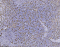 IHC staining of FFPE human tonsil tissue with AIF-1 antibody, HRP-secondary and DAB substrate. HIER: boil tissue sections in pH8 EDTA for 20 min and allow to cool before testing.