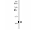 Western blot analysis of lysate from Drosophila tissue lysate using SUMO antibody diluted at 1:1000.